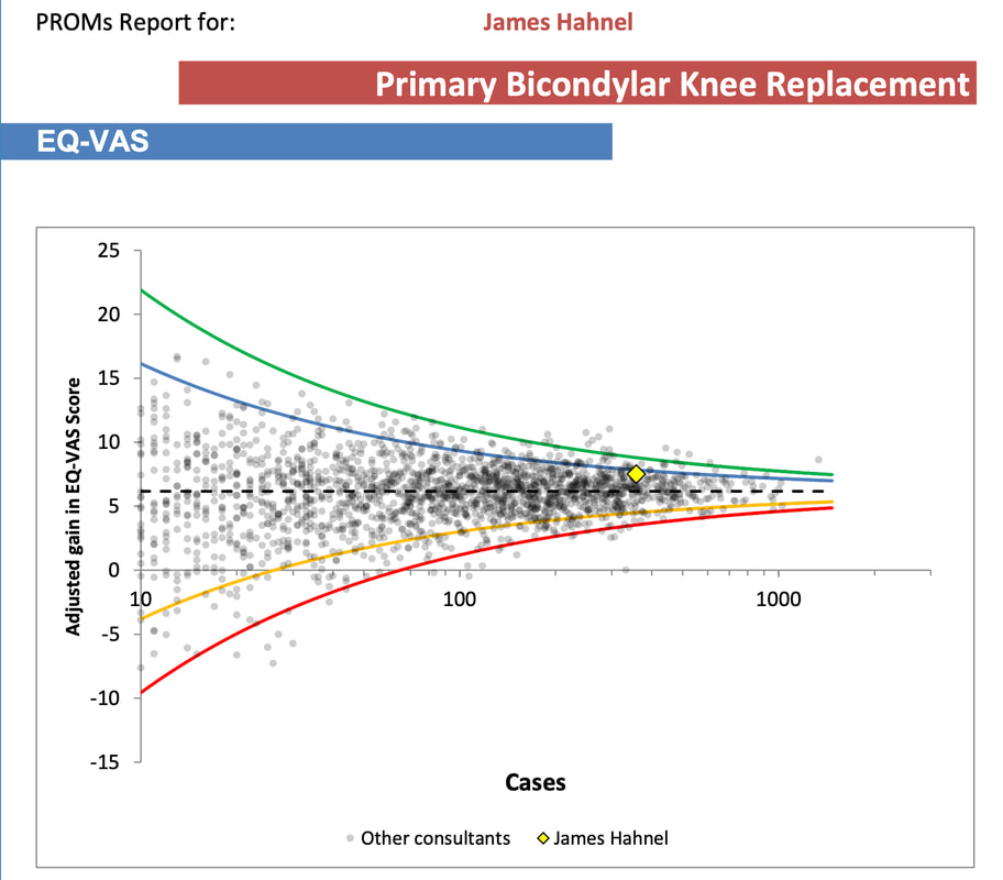 Funnel plot robotic knee surgery outcomes James Hahnel